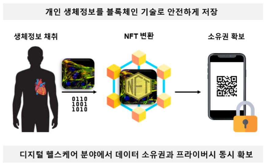 이미지 설명