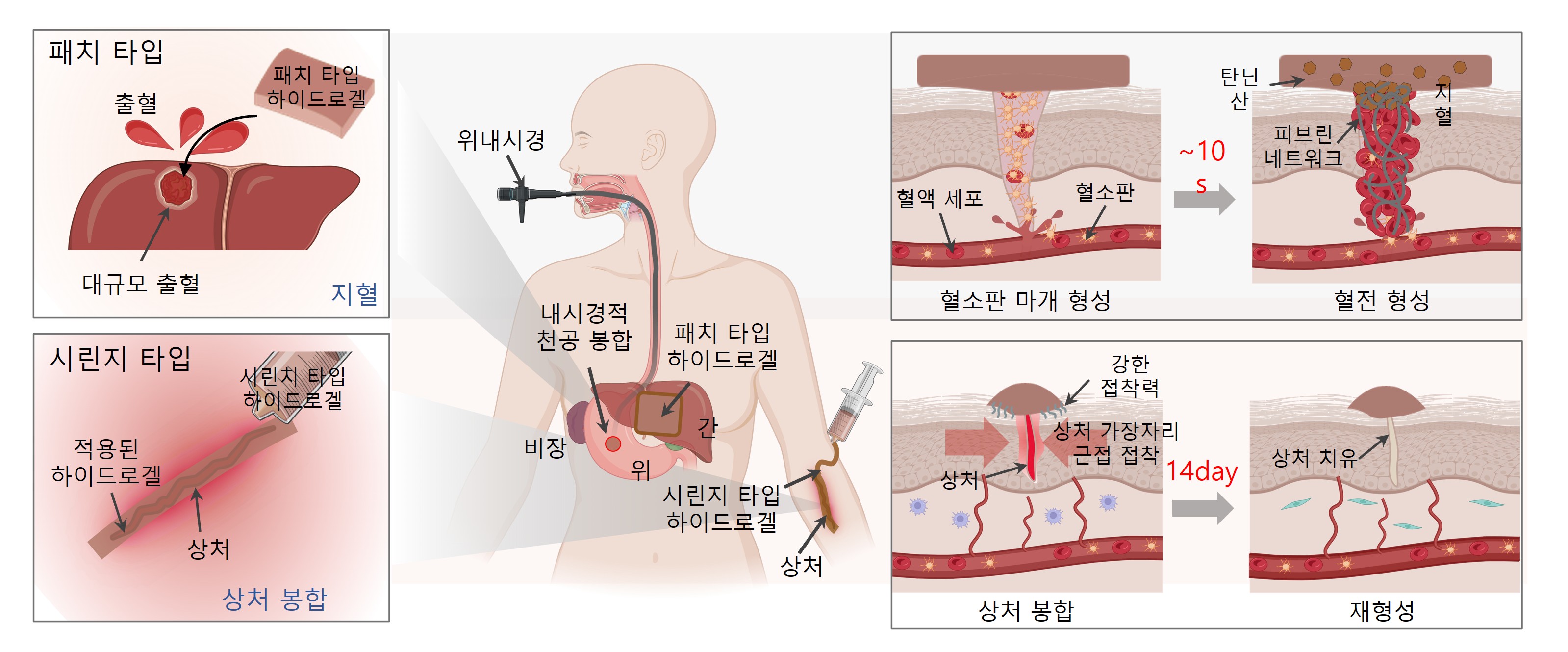 제품이미지