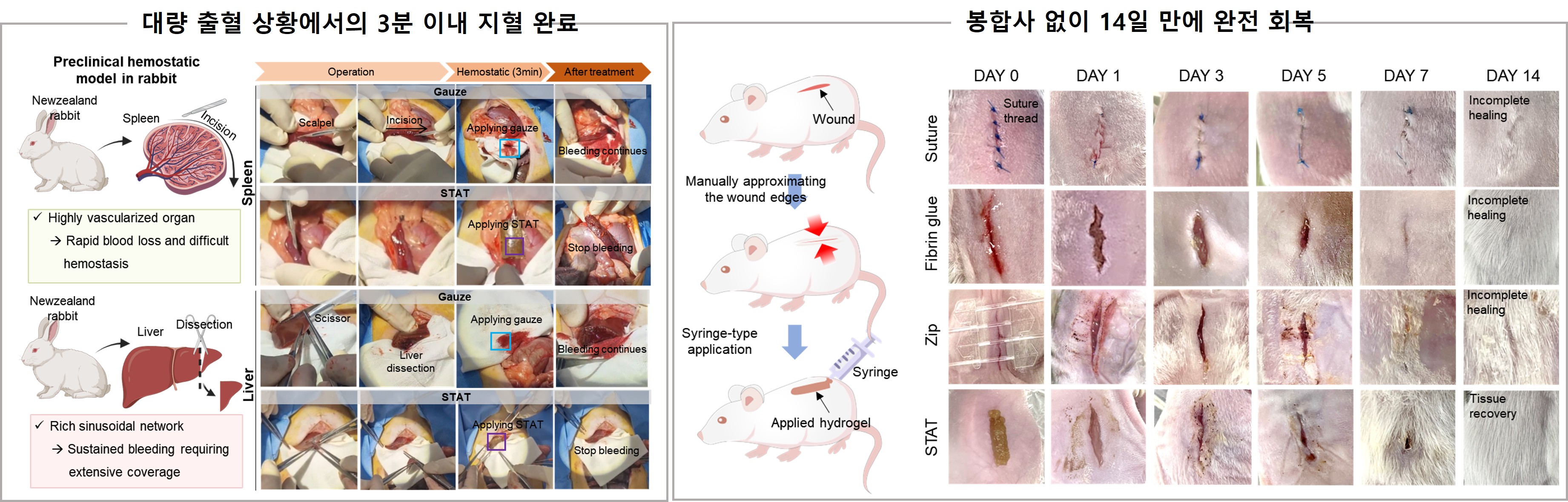 제품이미지