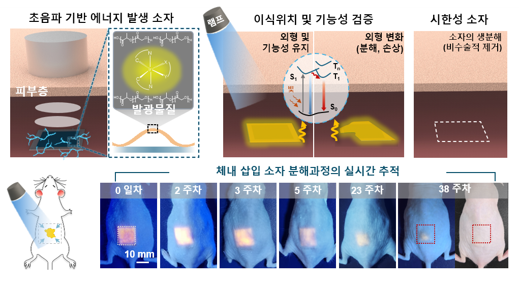 이미지 설명